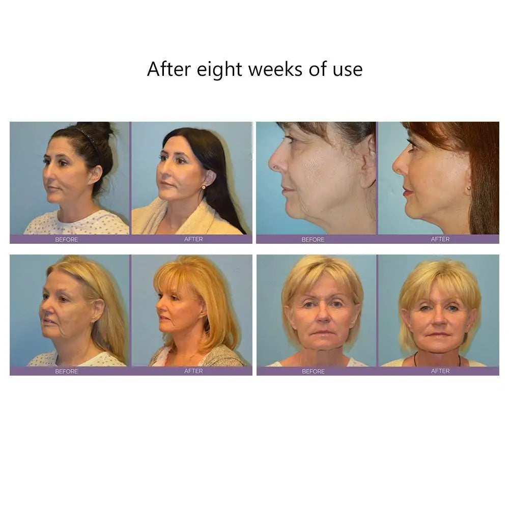 Facial Microcurrent Roller Massager | Non-Surgical Face Lift & Anti-Aging Therapy