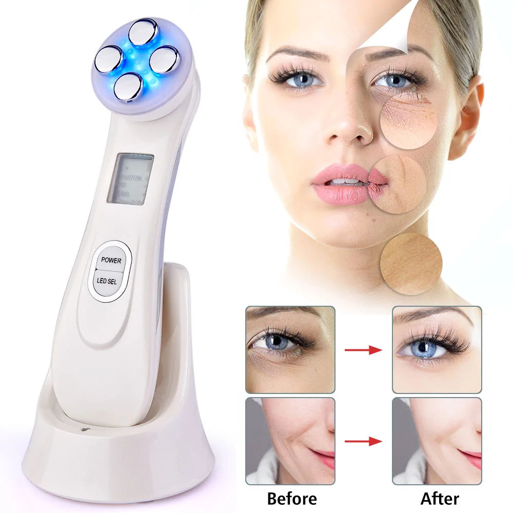 RF EMS LED Photon Facial Rejuvenation Device | Acne, Wrinkle & Skin Firming Treatment